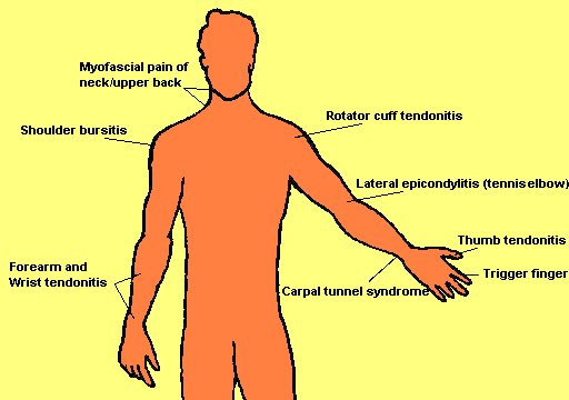 Musculoskeletal Symptoms